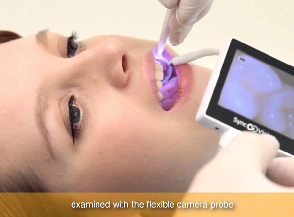 Intra Oral Camera