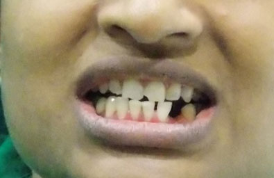 Before