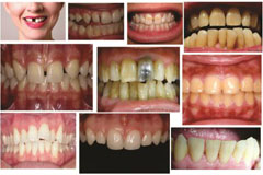 Dental Recommendation