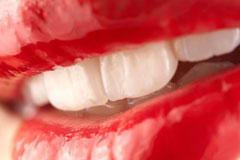 Smile Makeover Clinic in Aurangabad