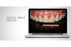 Smile Design Concept